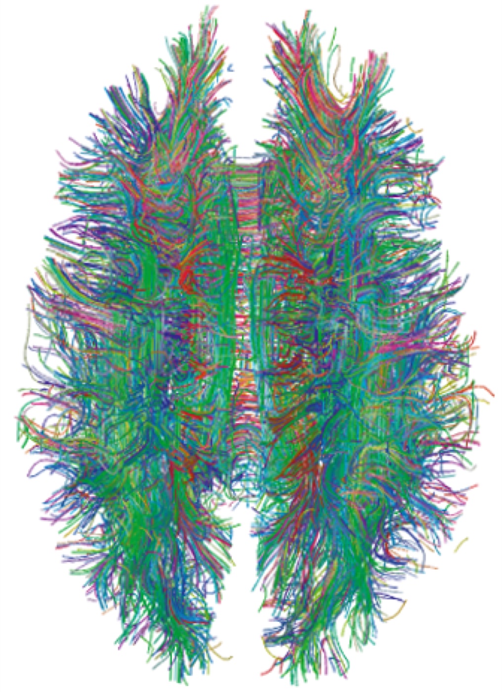 A diffusion-MRI tractography of a human brain: thousands of coloured white-matter nerve-fibre tracts mapped in 3D